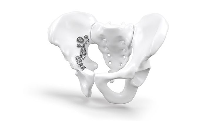 Nexos® Pelvis